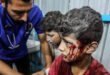 Three massacres during 24 hours in Gaza strip leaving 31 martyrs